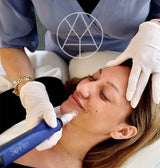 SKINPEN KUR AF ANSIGT + HALS M. 3 BEHANDLINGER (INKL. EFTERBEHANDLINGSCREMER)